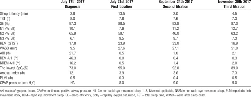 The comparison of sleep parameters before and after the CPAP therapy. The comparison of sleep parameters before and after the CPAP therapy.